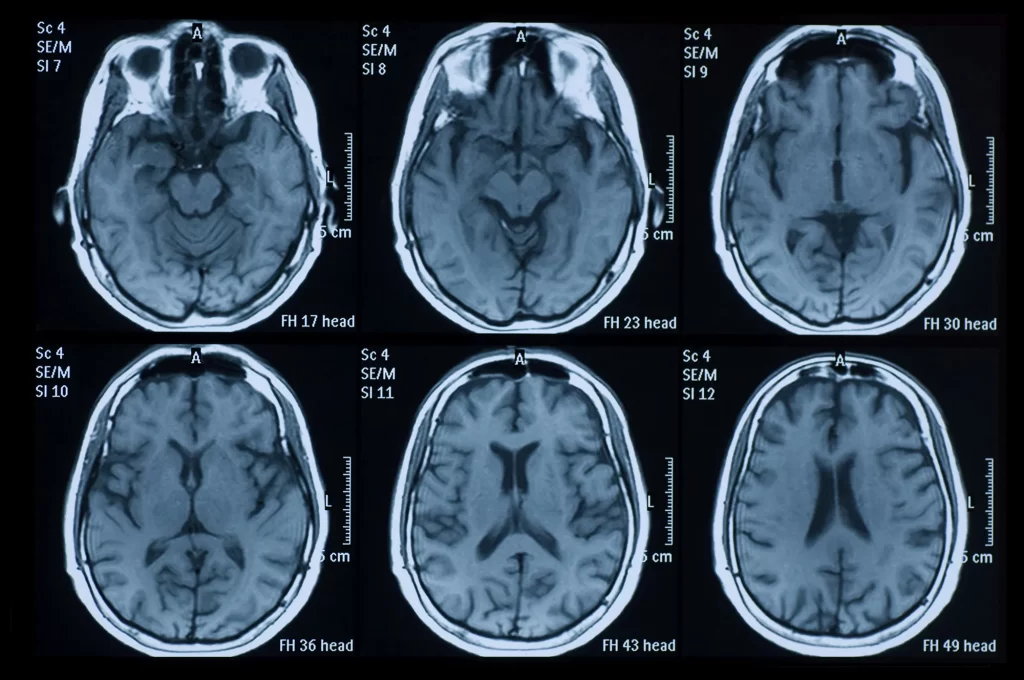TBI Testing Center